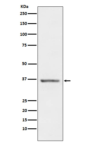 Stanniocalcin 1 Rabbit mAb