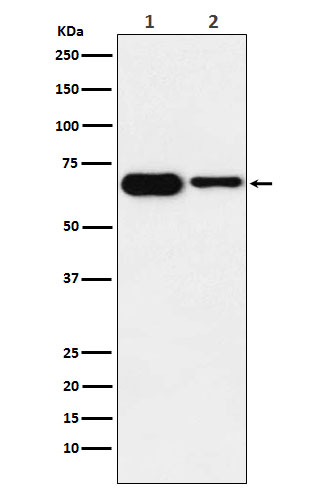 IGF2BP2 Rabbit mAb