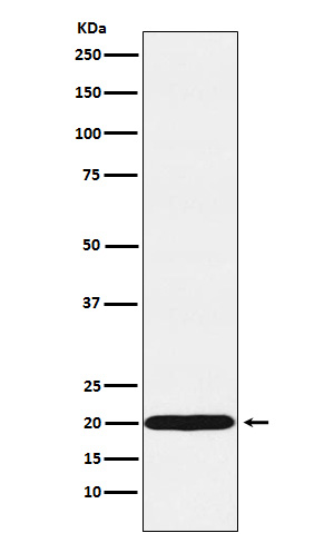 Ubiquitin Conjugating Enzyme E2 C Rabbit mAb