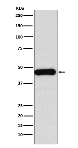 DNAJA1 Rabbit mAb