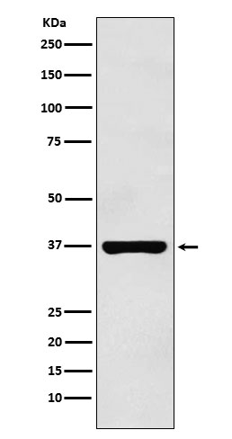 PIM2 Rabbit mAb