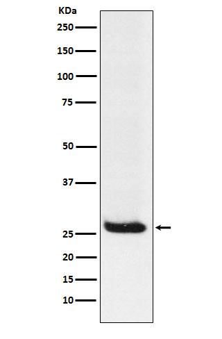 Hippocalcin  Rabbit mAb