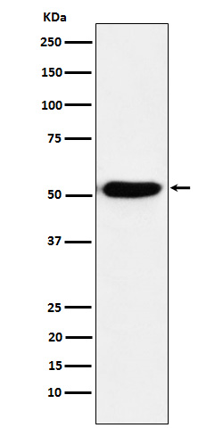 Interferon Regulatory Factor 4 Rabbit mAb