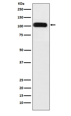 SERCA1 ATPase Rabbit mAb