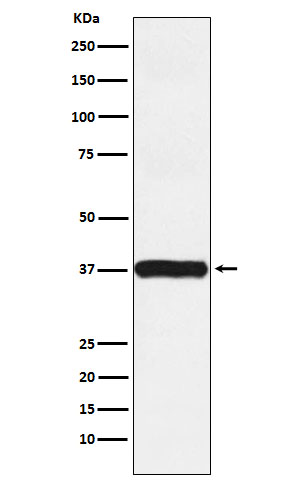 Actin Related Protein 2 Rabbit mAb