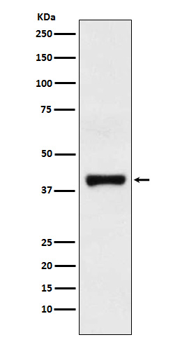 GOT2 Rabbit mAb