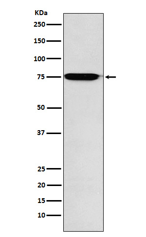 GAA Rabbit mAb