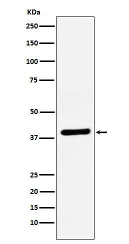 VEGFD Rabbit mAb