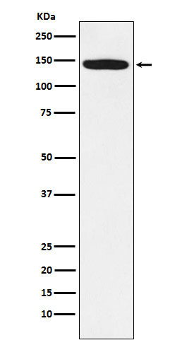 Tat SF1 Rabbit mAb