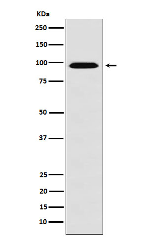 RanBP9  Rabbit mAb