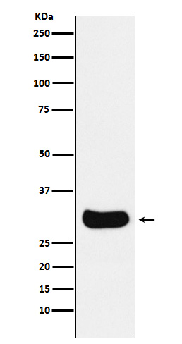 Gemin 2  Rabbit mAb