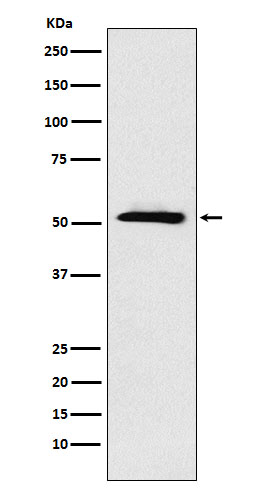 ETV6 Rabbit mAb