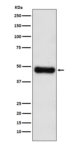 ADK Rabbit mAb