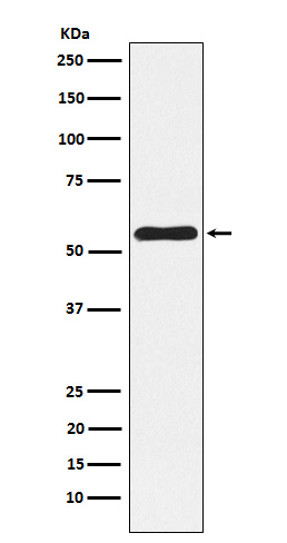 NLK Rabbit mAb