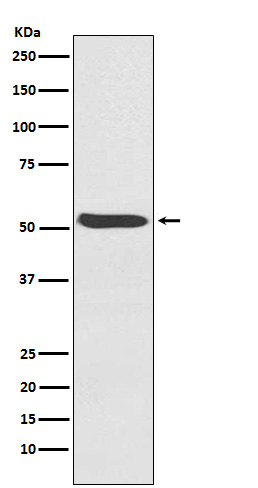 ACVR1 Rabbit mAb