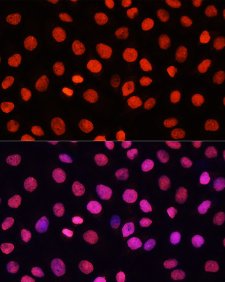 MonoMethyl-Histone H3 (Arg17) Rabbit mAb