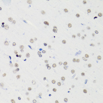 Acetyl-Histone H4 (Lys5) Rabbit mAb