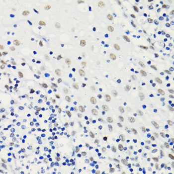 Acetyl-Histone H4 (Lys5) Rabbit mAb