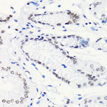 Acetyl-Histone H4 (Lys5) Rabbit mAb