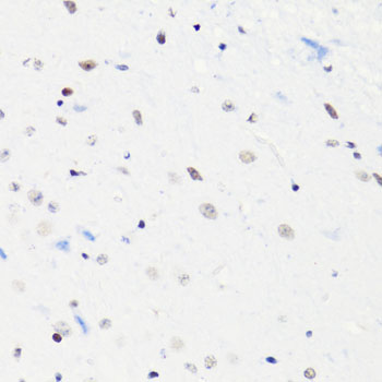 Acetyl-Histone H4 (Lys5) Rabbit mAb