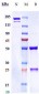 Anti-HBsAg Reference Antibody (OST 577)
