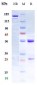 Anti-RGMA Reference Antibody (elezanumab)