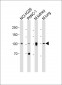 ROR1 antibody (C-term)