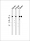 Neurofilament-L antibody