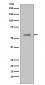 Anti-Phospho-p53 (S33) TP53 Rabbit Monoclonal Antibody
