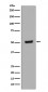 Anti-Phospho-p53 (T55) TP53 Rabbit Monoclonal Antibody