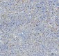 Anti-Phospho-Rb (S807) RB1 Rabbit Monoclonal Antibody