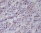 Anti-Phospho-p53 (S392) TP53 Rabbit Monoclonal Antibody