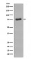 Anti-Phospho-BTK (Y223) Rabbit Monoclonal Antibody