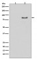 Anti-Phospho-HSL (S853) LIPE Rabbit Monoclonal Antibody