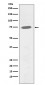 Anti-Phospho-BTK (Y551) Rabbit Monoclonal Antibody