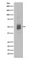 Anti-Phospho-Lyn (Y396) Rabbit Monoclonal Antibody