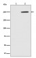 Anti-Phospho-GCN2 (T899) EIF2AK4 Rabbit Monoclonal Antibody