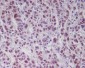 Anti-Phospho-ATM (S1981) Rabbit Monoclonal Antibody