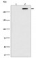 Anti-Phospho-ATM (S1981) Rabbit Monoclonal Antibody