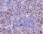 Anti-Phospho-c-Myc (S62) Rabbit Monoclonal Antibody