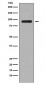 Anti-Phospho-RSK1 (S380) RPS6KA1 Rabbit Monoclonal Antibody