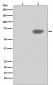 Anti-Phospho-PLK1 (T210) Rabbit Monoclonal Antibody