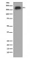 Anti-Phospho-EGFR (Y1092) Rabbit Monoclonal Antibody