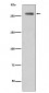 Anti-Phospho-LRRK2 (S935) Rabbit Monoclonal Antibody