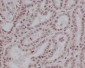 Anti-Phospho-Stat5 (Y694) STAT5A Rabbit Monoclonal Antibody