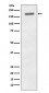 Anti-Phospho-EGFR (Y1173) Rabbit Monoclonal Antibody