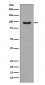 Anti-Phospho-FoxO3a (S253) Rabbit Monoclonal Antibody