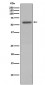 Anti-Phospho-Vimentin (S72) Rabbit Monoclonal Antibody