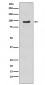 Anti-Phospho-p95/NBS1 (S343) NBN Rabbit Monoclonal Antibody