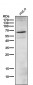 Anti-Phospho-ER alpha (S118) ESR1 Rabbit Monoclonal Antibody